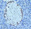 picture of a human beta islet cell that makes insulin