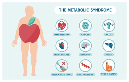 Signs and Symptoms of Metabolic Syndrome