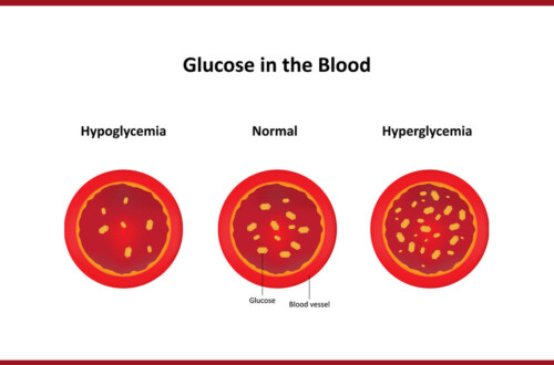 It is important to know the difference between high and low blood sugars so you can treat them properly